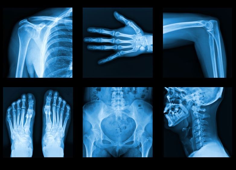 الأشعة السينية X-ray للعظام والأسنان