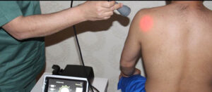 العلاج الطبيعي بالليزر الكهرومغناطيسي - ميديكال كير للعلاج الطبيعي المنزلي